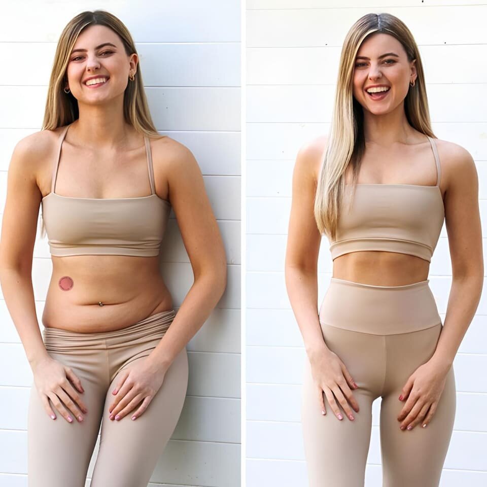 Ledisa GLP-1 Patches Patches image